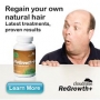 Free hair loss trial from the usa