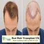 Best Hair Transplant Clinic London - Rejuvenate Hair Clinics